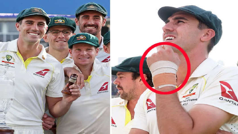 Australia captain Pat Cummins at risk of missing 3-match ODI series vs India due to suspected broken wrist, Full Report Here